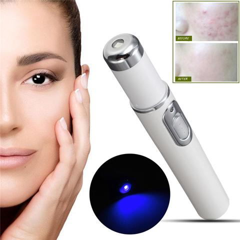Blue Light Therapy Acne Laser Pen: Scar, Wrinkle, and Acne Removal for Skin Care Beauty